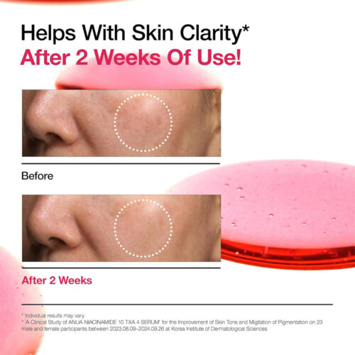 سرم ضد لک نیاسینامید 10% + ترانگزامیک اسید 4% آنوا - Anua Niacinamide 10% + TXA 4% Dark Spot Correcting Serum
