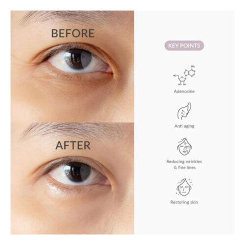 سرم دور چشم دکتر الیتا روشن کننده و جوانساز - Dr Althea To Be Eyeconic Eye Serum