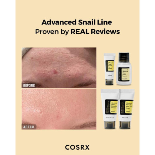 کیت ترمیم کننده پوست 4 مرحله ای حلزون کوزارکس - COSRX All About Snail Kit 4 Step