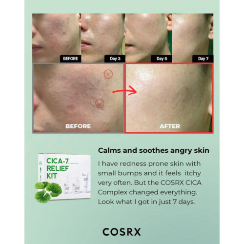 کیت سیکا 7 تسکین دهنده 3 مرحله ای کوزارکس - COSRX Cica-7 Relief Kit 3 Step