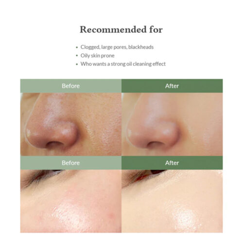 سرم پاک کننده چربی پوست پریمیوم کوئیک استپ دکتر التیا - Dr.Althea Premium Quick Step Sebum Cleanser