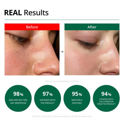 کرم آبرسان و تسکین دهنده رد بلمیش دکتر جی - Dr.G Red Blemish Clear Soothing Cream