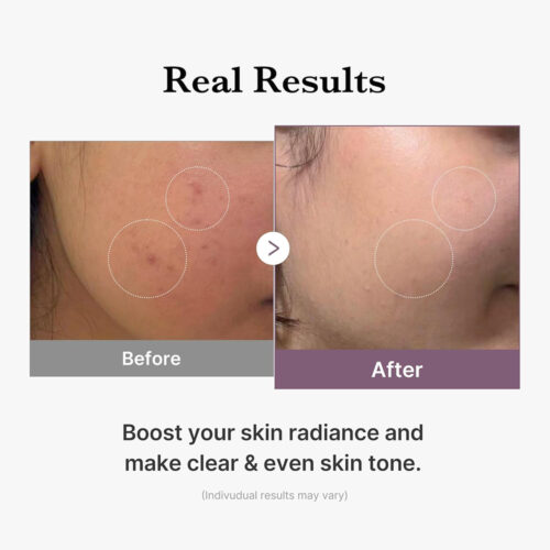 تونر گلوتاتیون مدی کیوب روشن کننده و جوانساز پوست Medicube Age-R Glutathione Glow Toner