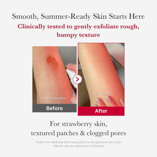 اسپری لایه بردار و ضد جوش بدن مدی کیوب - Medicube Red Acne Body Peeling Shot
