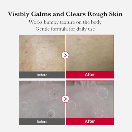 اسپری لایه بردار و ضد جوش بدن مدی کیوب - Medicube Red Acne Body Peeling Shot