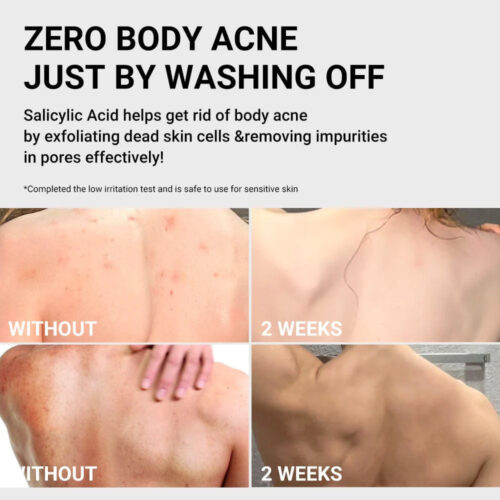 شوینده بدن ضد آکنه قرمز مدی کیوب - Medicube Red Acne Body Wash