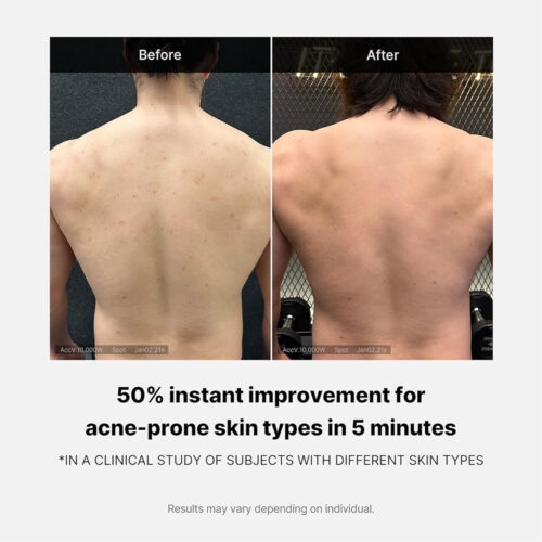 شوینده بدن ضد آکنه قرمز مدی کیوب - Medicube Red Acne Body Wash