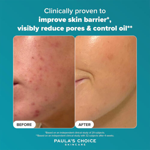 لایه بردار مایع حاوی 2% BHA پائولا چویس - Paula's Choice Skin Perfecting 2% BHA Liquid Exfoliant 118ml