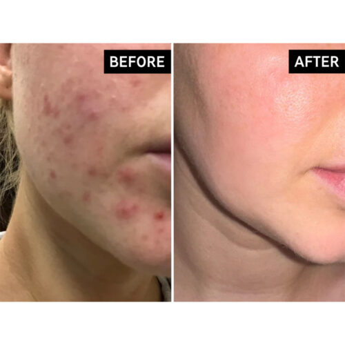 شوینده سالیسیلیک اسید اینکی لیست - The INKEY List Salicylic Acid Cleanser 150ml