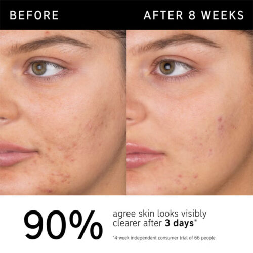 شوینده سالیسیلیک اسید اینکی لیست - The INKEY List Salicylic Acid Cleanser 150ml