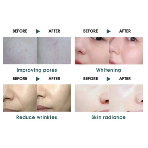 اسنس ضد چروک 100 PDRN وی تی کازمتیک - VT Cosmetics PDRN 100 Essence