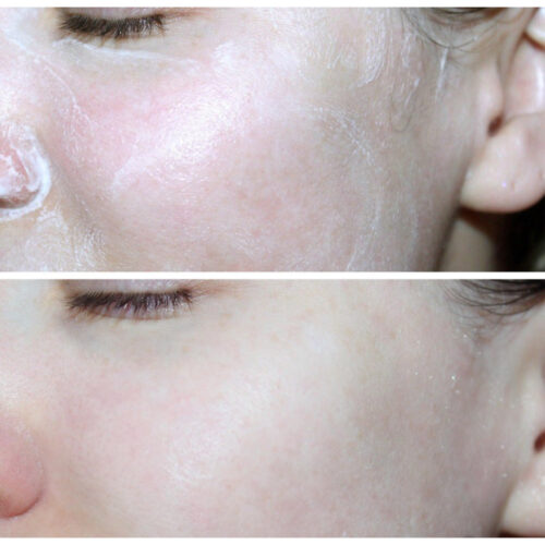 فوم شستشوی ضد جوش سیکا و BHA سلیمکس - Celimax Ji Woo Gae Cica BHA Acne Foam Cleansingفوم شستشوی ضد جوش سیکا و BHA سلیمکس - Celimax Ji Woo Gae Cica BHA Acne Foam Cleansing