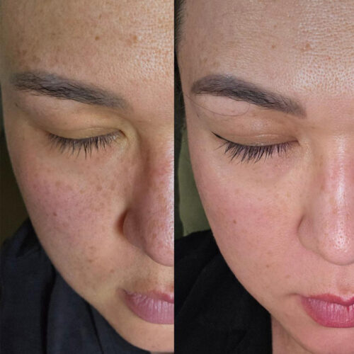 سرم ضد لک و روشن کننده آلفا آربوتین 2 درصد کوزارکس - Cosrx The Alpha-Arbutin 2 Discoloration Care Serum