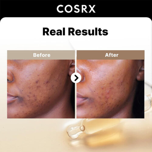 سرم ضد لک و روشن کننده آلفا آربوتین 2 درصد کوزارکس - Cosrx The Alpha-Arbutin 2 Discoloration Care Serum