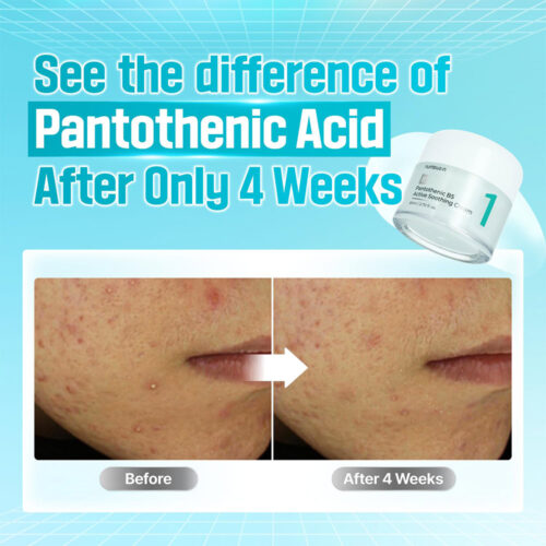 ژل کرم مرطوب کننده و تسکین دهنده شماره 1 نامبوزین - Numbuzin No.1 Pantothenic B5 Active Soothing Cream