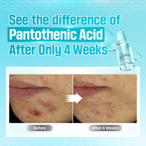 سرم شماره 1 تسکین دهنده و آبرسان پنتنول نامبوزین - Numbuzin No.1 Pantothenic B5 Active Soothing Serum