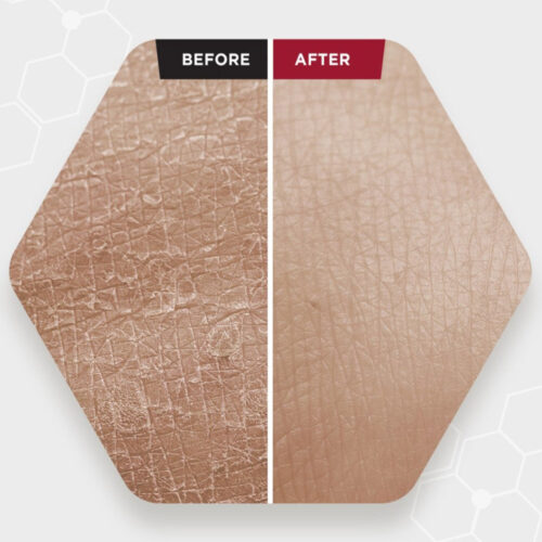 سرم پیلینگ و لایه بردار قوی زامبی بلادی اسکین 1004 - Skin1004 Zombie Beauty Bloody Peel