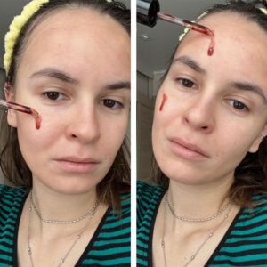 سرم پیلینگ و لایه بردار قوی زامبی بلادی اسکین 1004 - Skin1004 Zombie Beauty Bloody Peel
