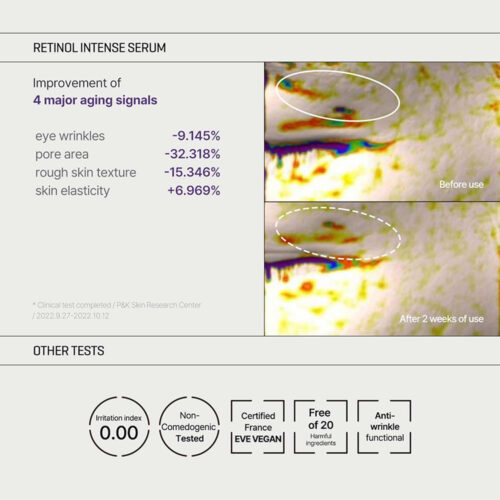 کیت ضد چروک و جوانساز رتینول سام بای می - Some by Mi Retinol Intense Trial Kit