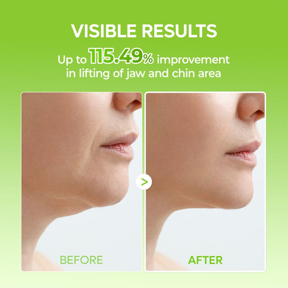 ماسک هیدروژلی خنککننده و فرمدهنده V-UP کاکتوکس دکتر ملاکسین
